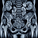 МРТ малого тазу у чоловіків